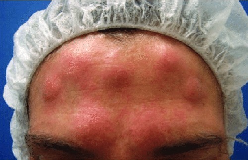 افزایش شکایات از کلینیکهای غیرمجاز و آرایشگاههادر شیراز/ رواج تزریقات غیرمجاز و عوارض جبرانناپذیر در شیراز